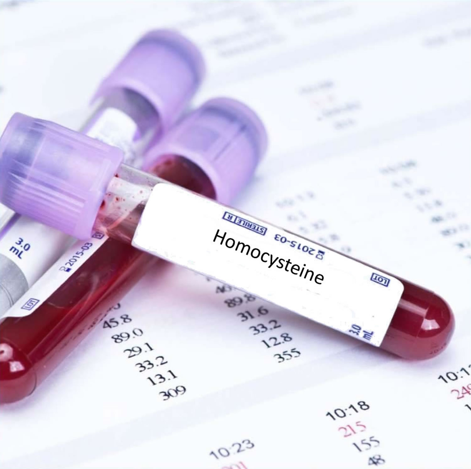 Methylation and Homocysteine, the Importance of Knowing Where You Stand